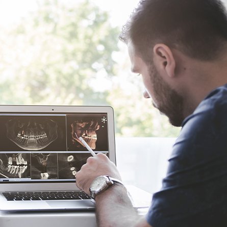 man pointing to dental x-ray