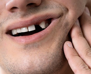 man smiling with missing tooth