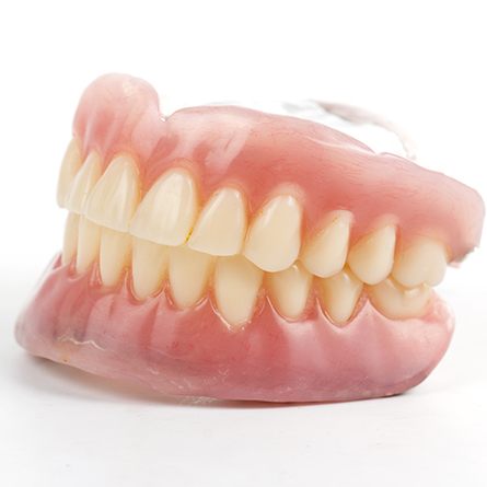 full denture mockup