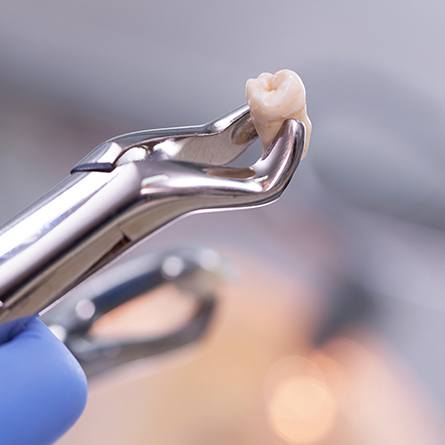 tooth in extraction tool