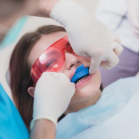 girl getting fluoride treatment