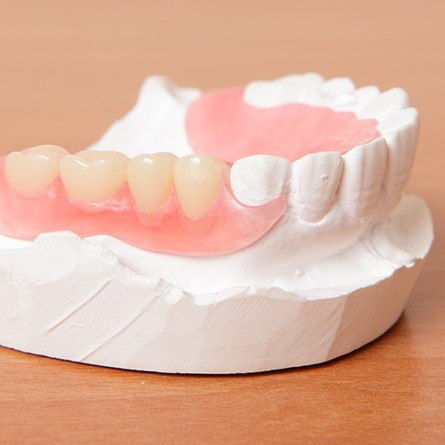 partial denture