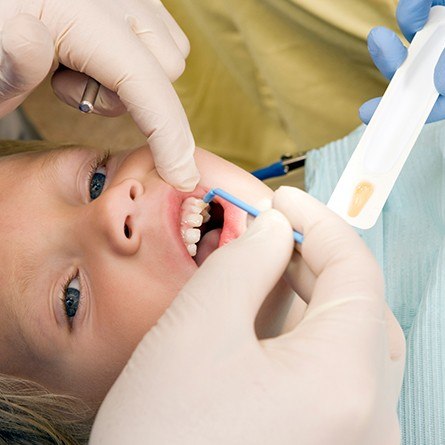 young girl getting fluoride treatment