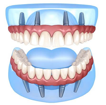 dentures illustration mockup