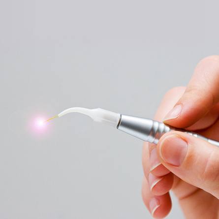 soft tissue laser