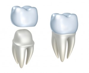 All-ceramic restorations from your cosmetic dentist in Stillwater Ranch.