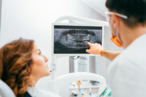dentist explaining dental x-rays