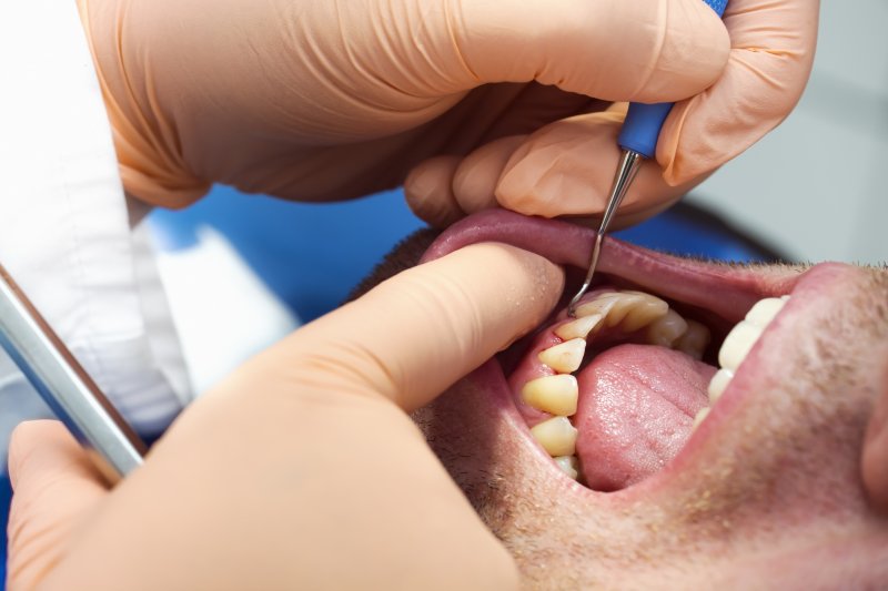 a male patient having his teeth and gums cleaned